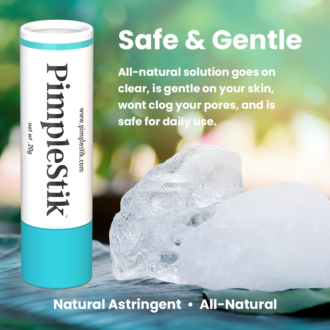 PimpleStik All Natural Pimple Spot Treatment