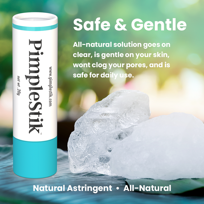 PimpleStik All Natural Pimple Spot Treatment